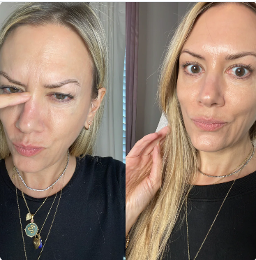 Glowskin Pro - Masajeador Facial + Serum Hidratante GRATIS